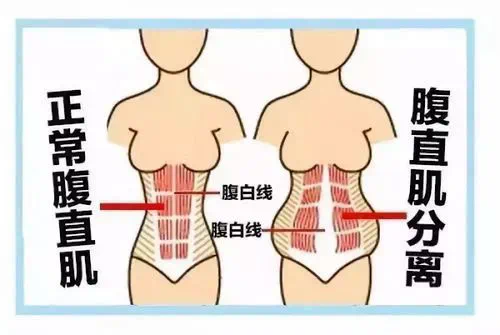 孕前小蠻腰，孕后似錢包？來看看解決辦法吧！