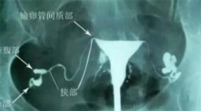 給高齡備孕女性的忠告：5個誤區(qū)，提前知道！
